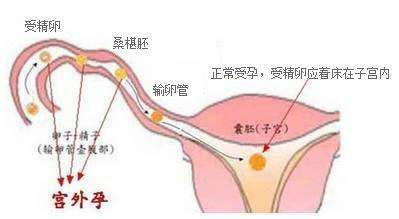 肥妈妈孕前保健攻略